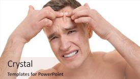  Presentation with skin infections erythroderma - PPT layouts featuring acne vulgaris - handsome young man with problem background and a  colored foreground