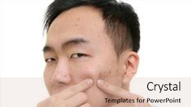  Presentation with asian nurse helps a man - Audience pleasing presentation consisting of acne vulgaris - young asian man popping pimples backdrop and a lemonade colored foreground