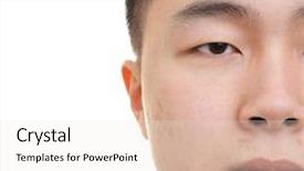  Presentation with asian nurse helps a man - Presentation enhanced with acne vulgaris - young asian man with problem background and a white colored foreground