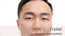  Presentation with bud - Cool new presentation theme with acne vulgaris - young asian man with problem backdrop and a lemonade colored foreground