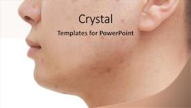  Presentation with acne vulgaris - PPT layouts with acne vulgaris - young man with problem skin background and a coral colored foreground