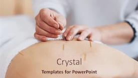  Presentation with needle - Presentation theme enhanced with acupuncture-needle-therapy background and a lemonade colored foreground