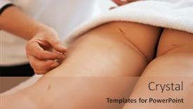  Presentation with needle - Theme featuring acupuncture-needle-therapy background and a coral colored foreground