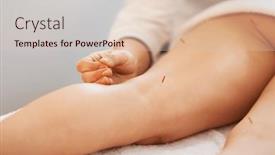  Presentation with acupuncture - Slides enhanced with acupuncture-needle-therapy background and a lemonade colored foreground