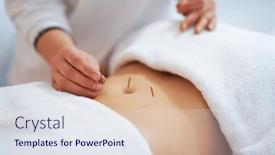  Presentation with acupuncture - Presentation enhanced with acupuncture-needle-therapy background and a sky blue colored foreground