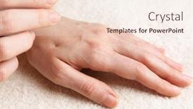  Presentation with acupuncture - Audience pleasing presentation theme consisting of acupuncture on hand close up isolated on white backdrop and a lemonade colored foreground