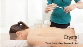  Presentation with acupuncture - PPT layouts enhanced with acupuncturist heating up a glass background and a lemonade colored foreground