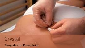  Presentation with acupuncture - Slide set enhanced with acupuncturist-performing-acupuncture background and a coral colored foreground