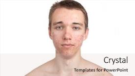  Presentation with flexible skin electronics - Beautiful slide deck featuring adolescent health - handsome young man with skin backdrop and a lemonade colored foreground