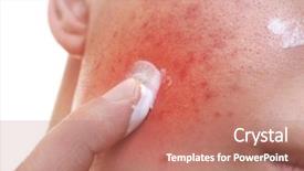  Presentation with skin care - Cool new PPT layouts with adolescent health - skin care concept young man backdrop and a coral colored foreground