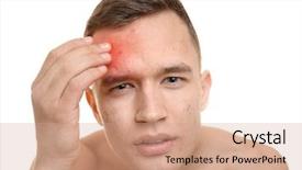  Presentation with skin care - Audience pleasing PPT theme consisting of adolescent health - skin care concept young man backdrop and a coral colored foreground