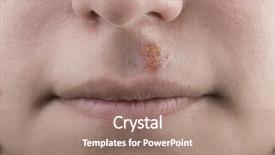  Presentation with lips - Slide deck having affecting teenagers - close up of lips affected background and a coral colored foreground