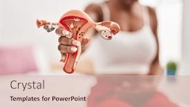  Presentation with uterus - Theme consisting of african-american-woman-suffering background and a lemonade colored foreground