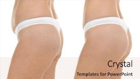  Presentation with woman body - PPT theme featuring after liposuction plastic surgery background and a coral colored foreground