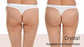  Presentation with woman body - Slide set consisting of after liposuction plastic surgery background and a coral colored foreground