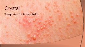  Presentation with body - Slide set consisting of allergic rash on the body background and a lemonade colored foreground