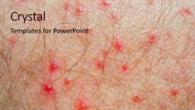  Presentation with skin infection - Colorful PPT theme enhanced with natural disasters damage backdrop and a dark gray colored foreground