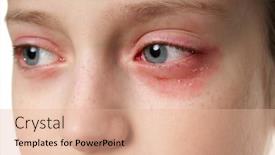  Presentation with skin disease - Theme with allergic-reaction-skin-rash-close background and a lemonade colored foreground