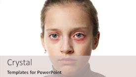  Presentation with skin disease - Cool new PPT theme with allergic-reaction-skin-rash-close backdrop and a soft green colored foreground