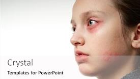 Presentation with inflammation - Slide deck enhanced with allergic-reaction-skin-rash-close background and a white colored foreground