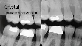  Presentation with periodontal - PPT layouts with alveolar bone - left periodontal x-rays background and a light gray colored foreground
