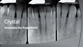  Presentation with periodontal - Presentation having alveolar bone - lower periodontal x-rays background and a gray colored foreground