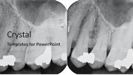  Presentation with periodontal - Beautiful presentation theme featuring alveolar bone - right upper periodontal x-rays backdrop and a light gray colored foreground