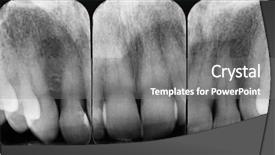  Presentation with periodontal - Slides with alveolar bone - upper periodontal x-rays background and a gray colored foreground