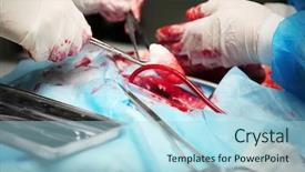  Presentation with amputation - Slide deck having amputation - doctor doing heart operation background and a light blue colored foreground
