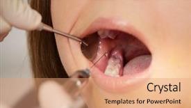  Presentation with anaesthesia - PPT layouts having store he sees his reflection background and a gray colored foreground