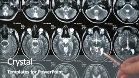  Presentation with roentgen - Slides consisting of anamnesis - doctor examining an roentgen background and a gray colored foreground