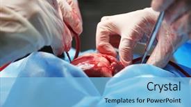  Presentation with heart anatomy - Presentation enhanced with anatomy - doctor doing heart operation background and a light blue colored foreground