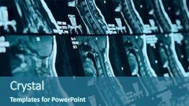  Presentation with anatomy neck - Beautiful slides featuring anatomy - head and neck mri scan backdrop and a ocean colored foreground