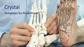  Presentation with comparison - Slide deck consisting of anatomy - presentation of human foot background and a lemonade colored foreground