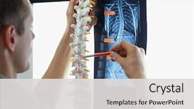  Presentation with treatment - Audience pleasing theme consisting of anatomy - scoliosis - specialist with model backdrop and a light gray colored foreground
