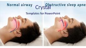  Presentation with airway - Cool new slide set with anatomy - snore problem concept illustration backdrop and a sky blue colored foreground