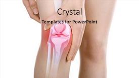  Presentation with knee - Slides having anatomy - young woman with knee pain background and a lemonade colored foreground