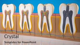 Presentation with nerves - Beautiful presentation design featuring anatomy of the tooth backdrop and a coral colored foreground