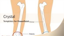  Presentation with anatomy bones - Theme enhanced with anatomy thigh - knee joint - front background and a lemonade colored foreground