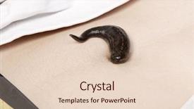  Presentation with medicinal chemistry - Amazing presentation design having animal organ - medicinal leech-hirudo medicinalis backdrop and a  colored foreground