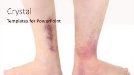  Presentation with ankle - Amazing slide set having young woman going to dead sea israel backdrop and a light blue colored foreground