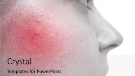  Presentation with anti virus - Slide set featuring anti virus - skin care concept young woman background and a coral colored foreground