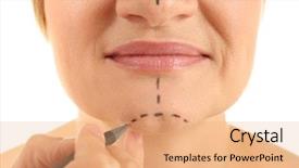  Presentation with hand surgeon - Slides enhanced with anti wrinkle - surgeon hand drawing marks background and a  colored foreground