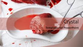  Presentation with medical heart - Beautiful slides featuring aorta - heart organ in medical metal backdrop and a red colored foreground