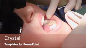  Presentation with mouth tooth - Slide set enhanced with applying-resin-based-composite-filling background and a coral colored foreground