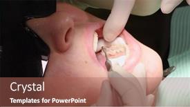  Presentation with mouth tooth - Slide set consisting of applying-resin-based-composite-filling background and a red colored foreground