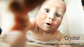  Presentation with dermatitis - Audience pleasing PPT theme consisting of atop - little baby with dermatitis backdrop and a coral colored foreground