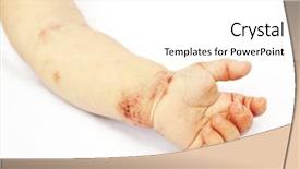  Presentation with woman covering man mouth hand - Presentation theme consisting of atop - small hand of child covered background and a white colored foreground