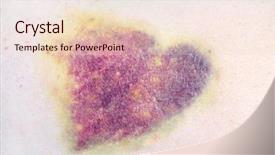  Presentation with violence - Theme consisting of awareness violence - closeup of a heart shaped background and a lemonade colored foreground