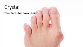  Presentation with accident - PPT layouts with baby accident - dislocated little toe big toe background and a white colored foreground